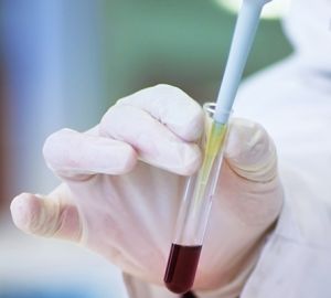 Новые российские тесты позволят еще быстрее выявлять коронавирус