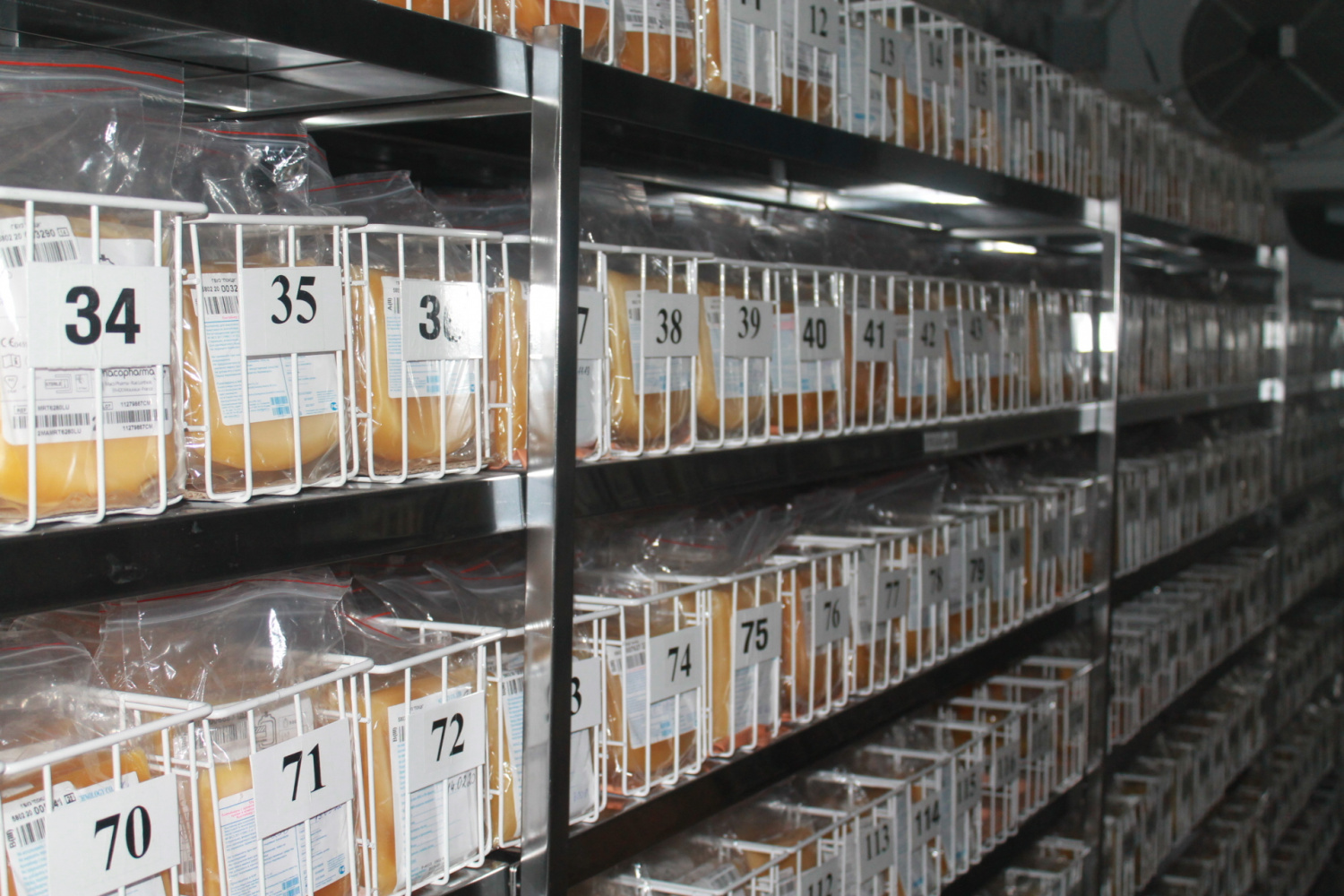 В Пензе пациенту с коронавирусом впервые перелили антиковидную плазму