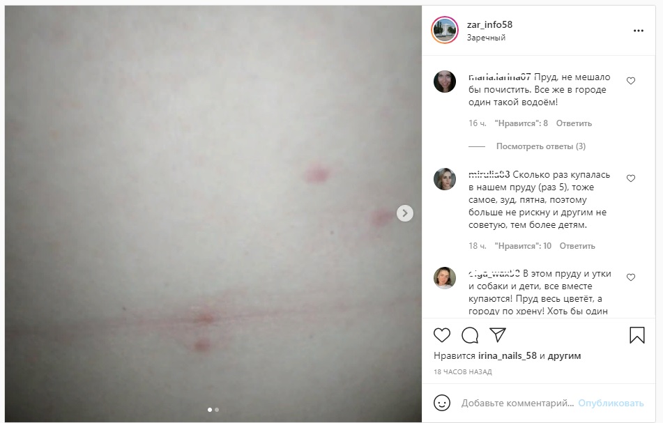 В пруду Заречного отдыхающих подстерегает опасная болезнь