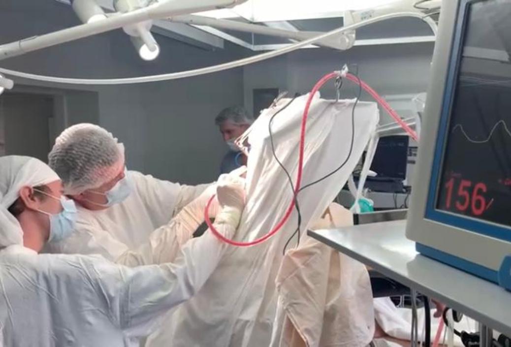 Пензенские нейрохирурги использовали новую методику при проведении операции на головном мозге