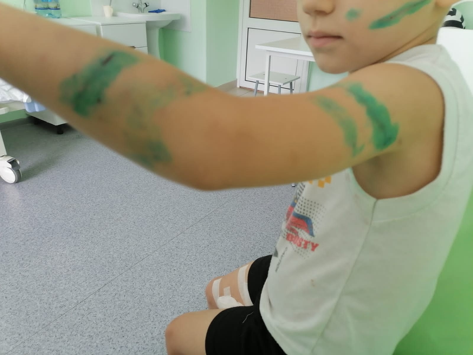 В Бессоновке займутся отловом собак после инцидента с покусанным ребенком