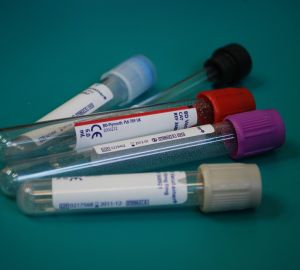 Анна Попова назвала Пензу в числе регионов, где долго ждут результаты ПЦР-теста