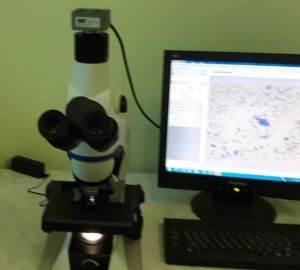 В больнице Кузнецка появился прибор для быстрой диагностики рака кишечника