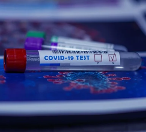 Пензенцам разъяснили, когда ПЦР-тесты на COVID-19 проводят бесплатно