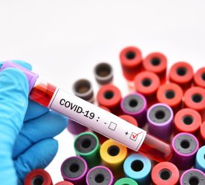 В Пензе снизился уровень коллективного иммунитета от ковида