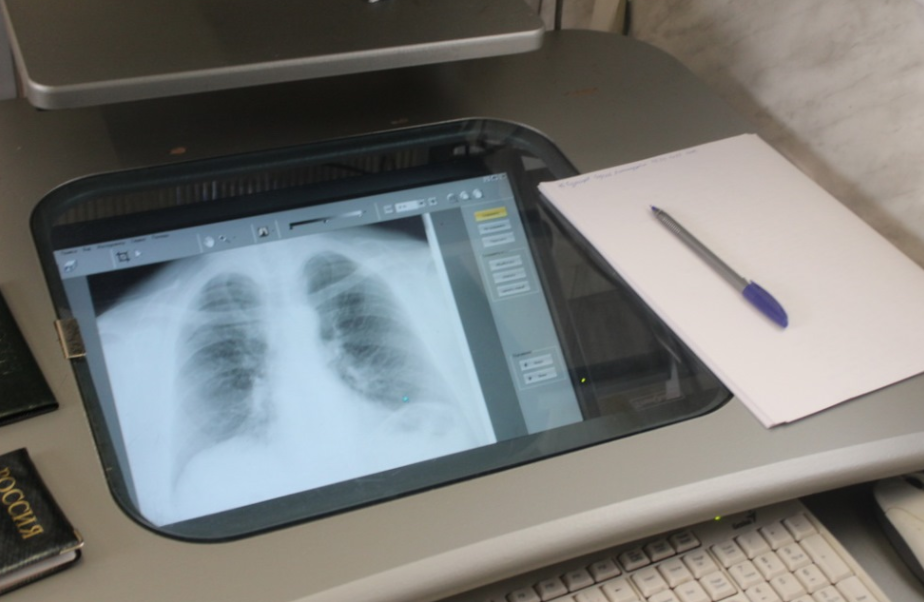 Пензенцев приглашают пройти флюорографию