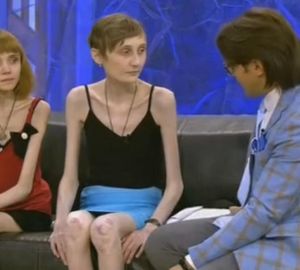 Жительница Барнаула, которая весила 17 килограммов, идет на поправку. Фото