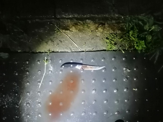 В Пензенском районе мужчина умер после того, как получил удар ножом от жены в ногу