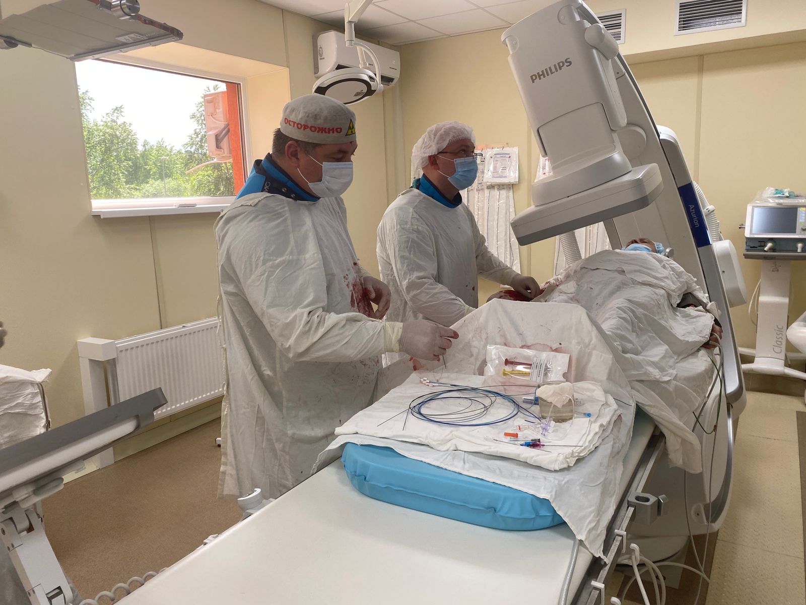 В Пензе впервые провели операцию по приостановке распространения раковой опухоли в печени