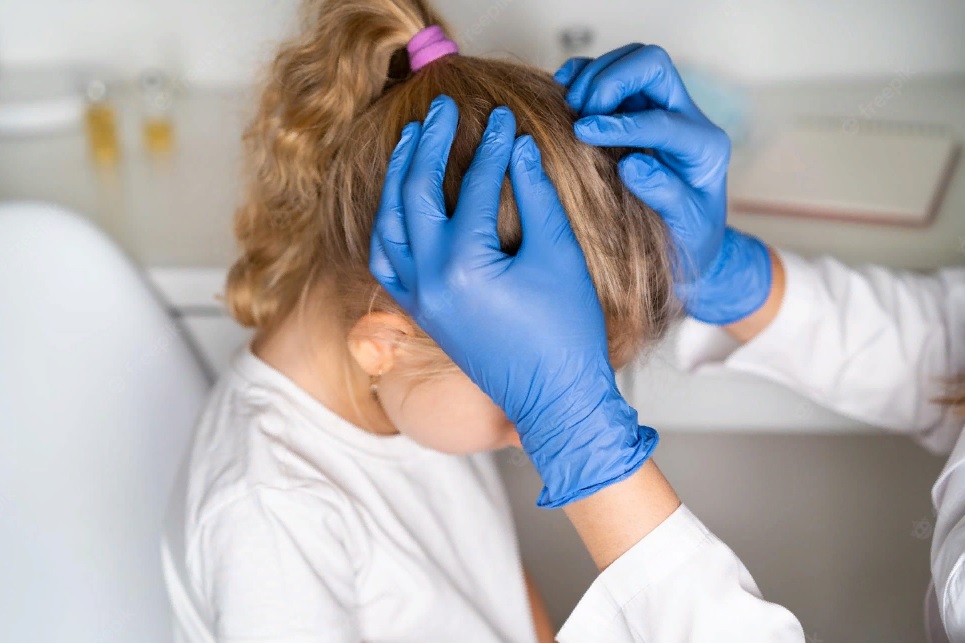 В Роспотребнадзоре напомнили об опасности заражения педикулезом