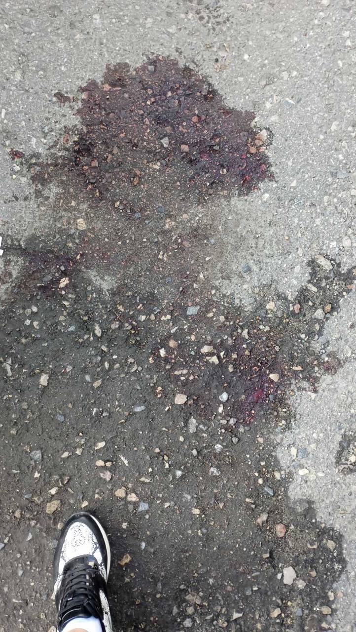 «Все в крови»: в ночном конфликте на ГПЗ пострадала женщина