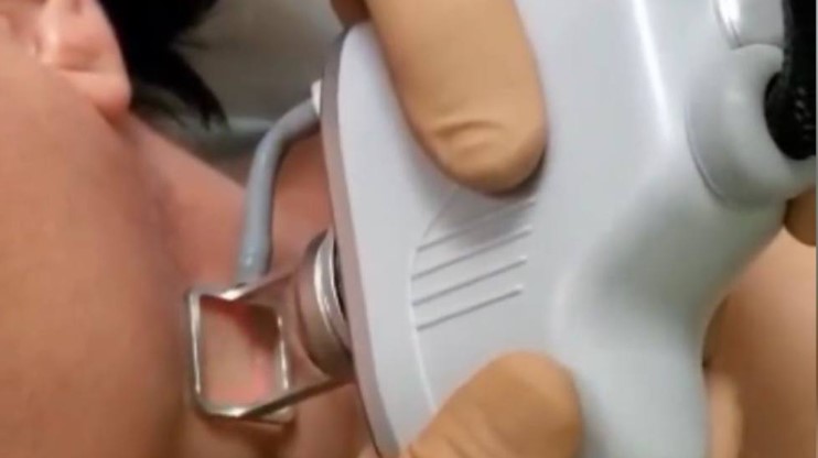 В больницу Бурденко поступил современный лазер для омоложения кожи