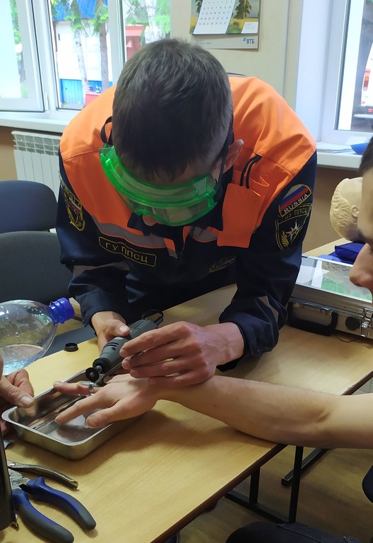 Спасатели помогли снять кольцо с пальца обожженного пензенца