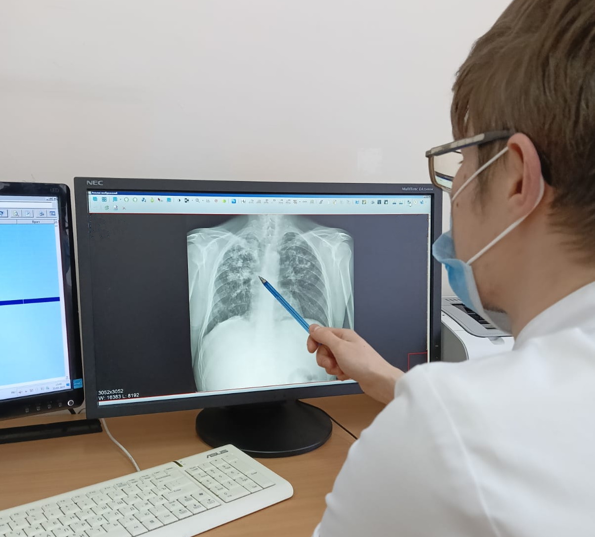 В Пензенской области в 2023 году туберкулез нашли у 5 человек