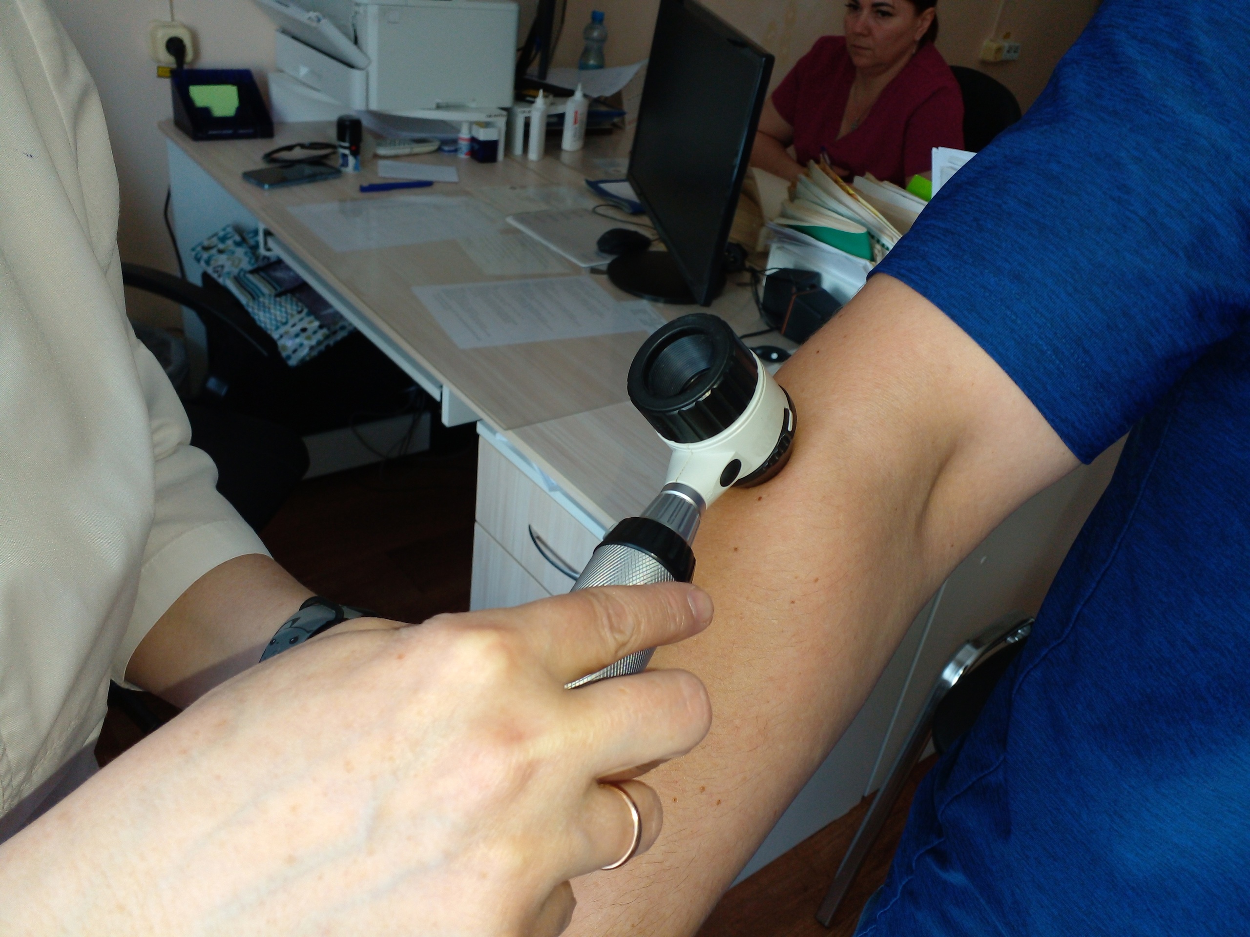 В Пензенской области 150 жителей проверили свои родинки на онкозаболевнаия