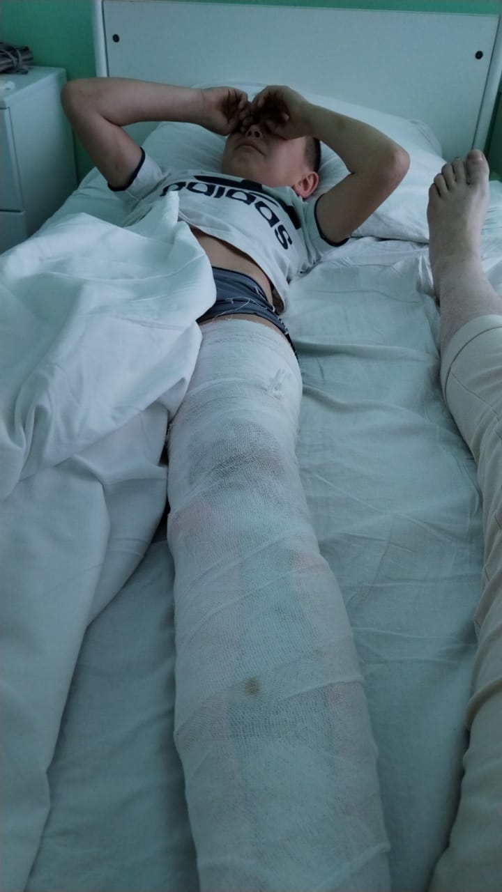 Мама сбитого на самокате мальчика рассказала, как он себя чувствует на самом деле