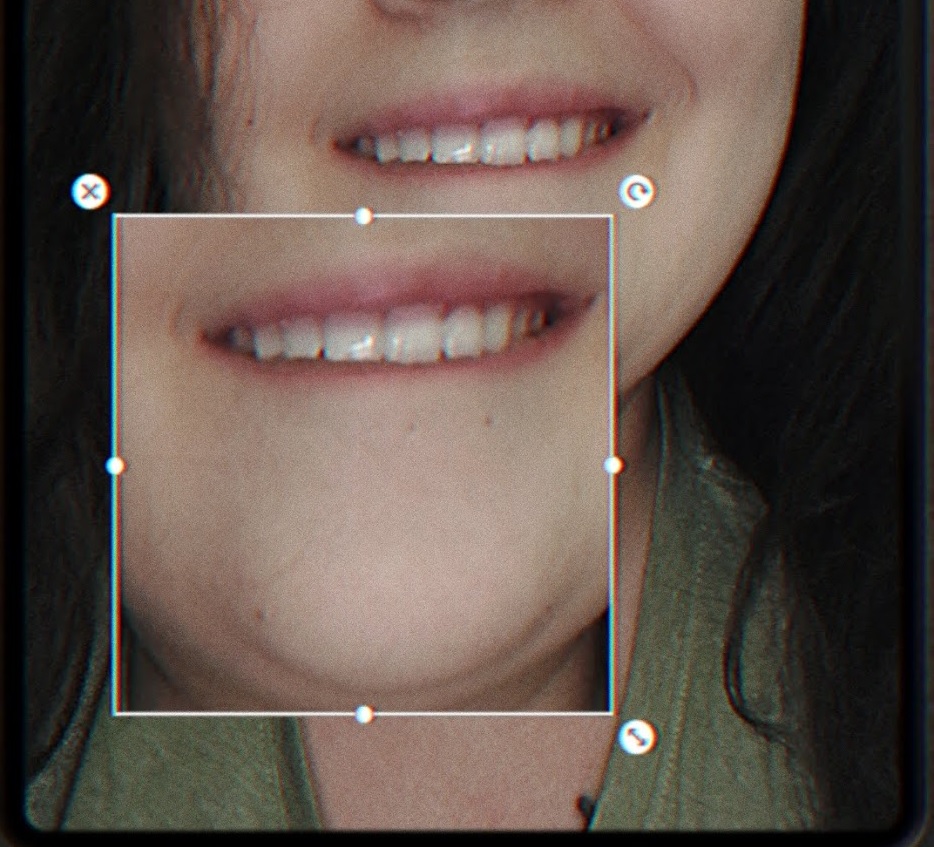 В РФ на 16% вырос спрос на услуги стоматологов