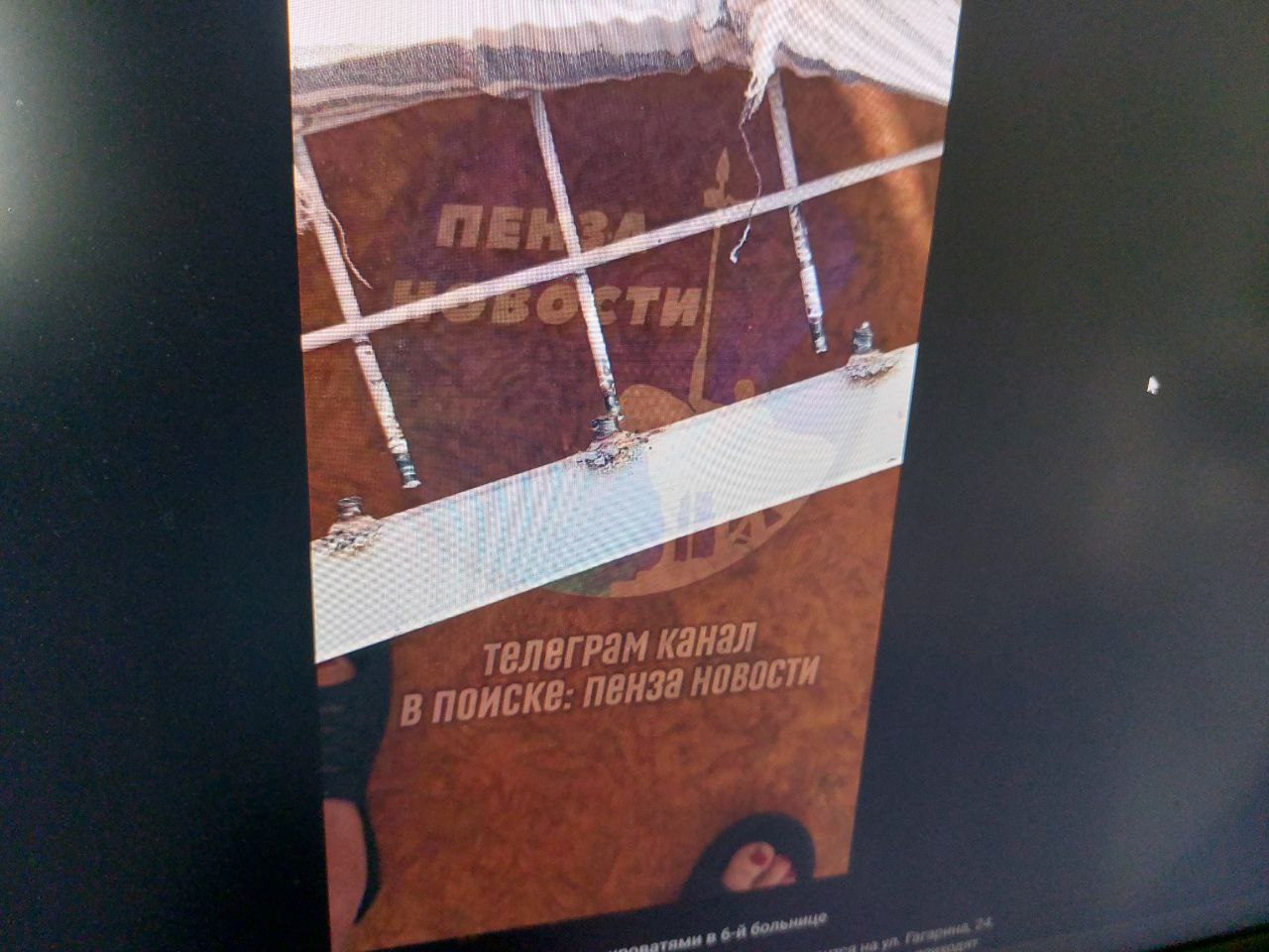 В Пензе пациентов больницы уложили на сломанные кровати