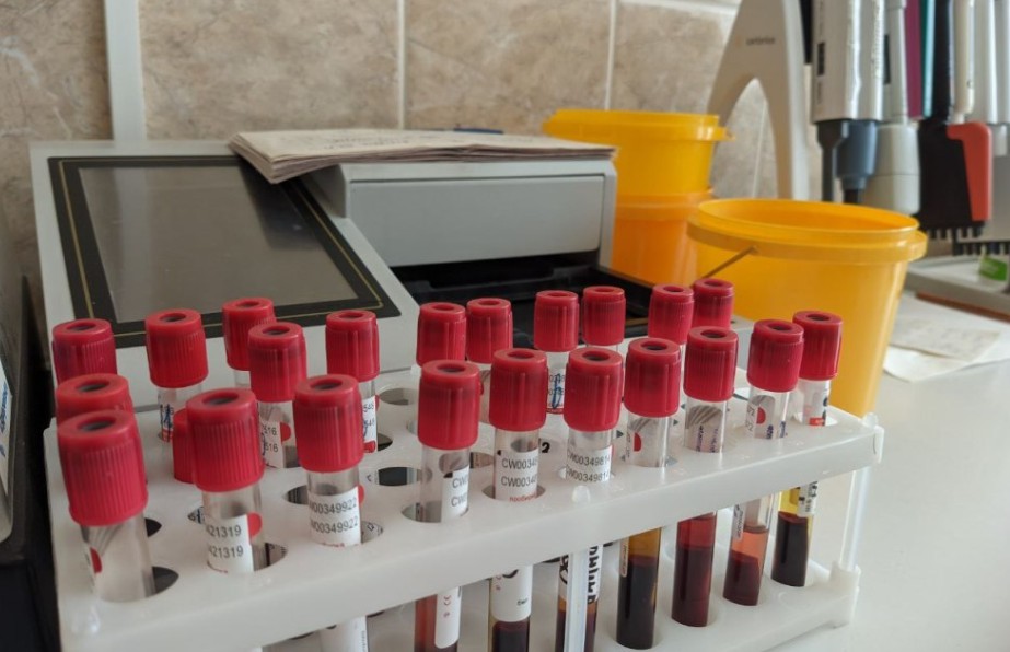 Пензенцы могут сдать бесплатный тест на ВИЧ