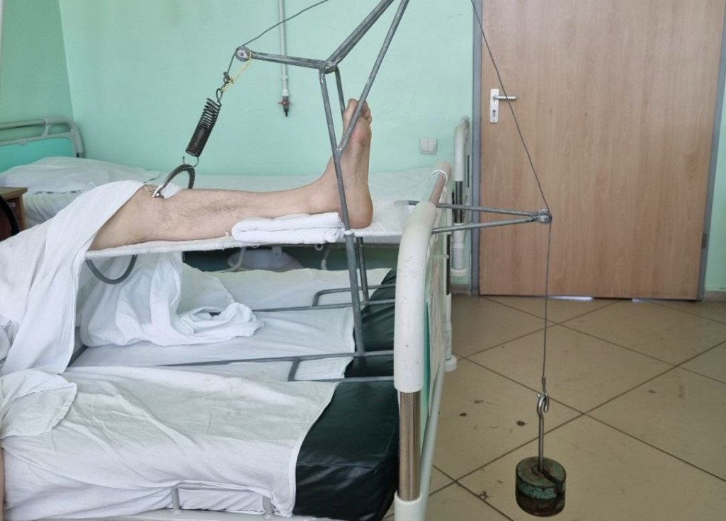 В Пензе мужчина сломал два локтевых сустава на Олимпийской аллее