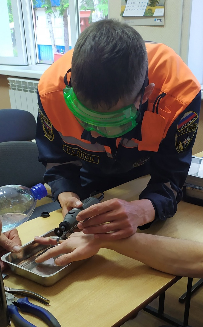 В Пензе спасатели освободили женщину от кольца, мешавшего наложить гипс