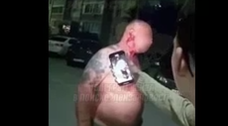 Окровавленный мужчина с оторванной мочкой уха шокировал жителей Арбеково