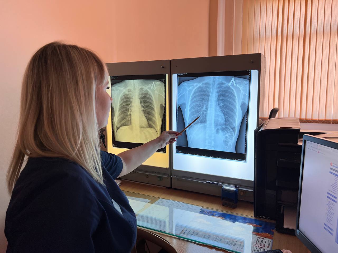 Главный пензенский онколог рассказал, чем опасны электронные заменители сигарет