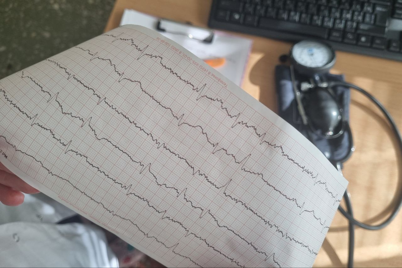 Почему мужчины чаще страдают от болезней сердца, чем женщины