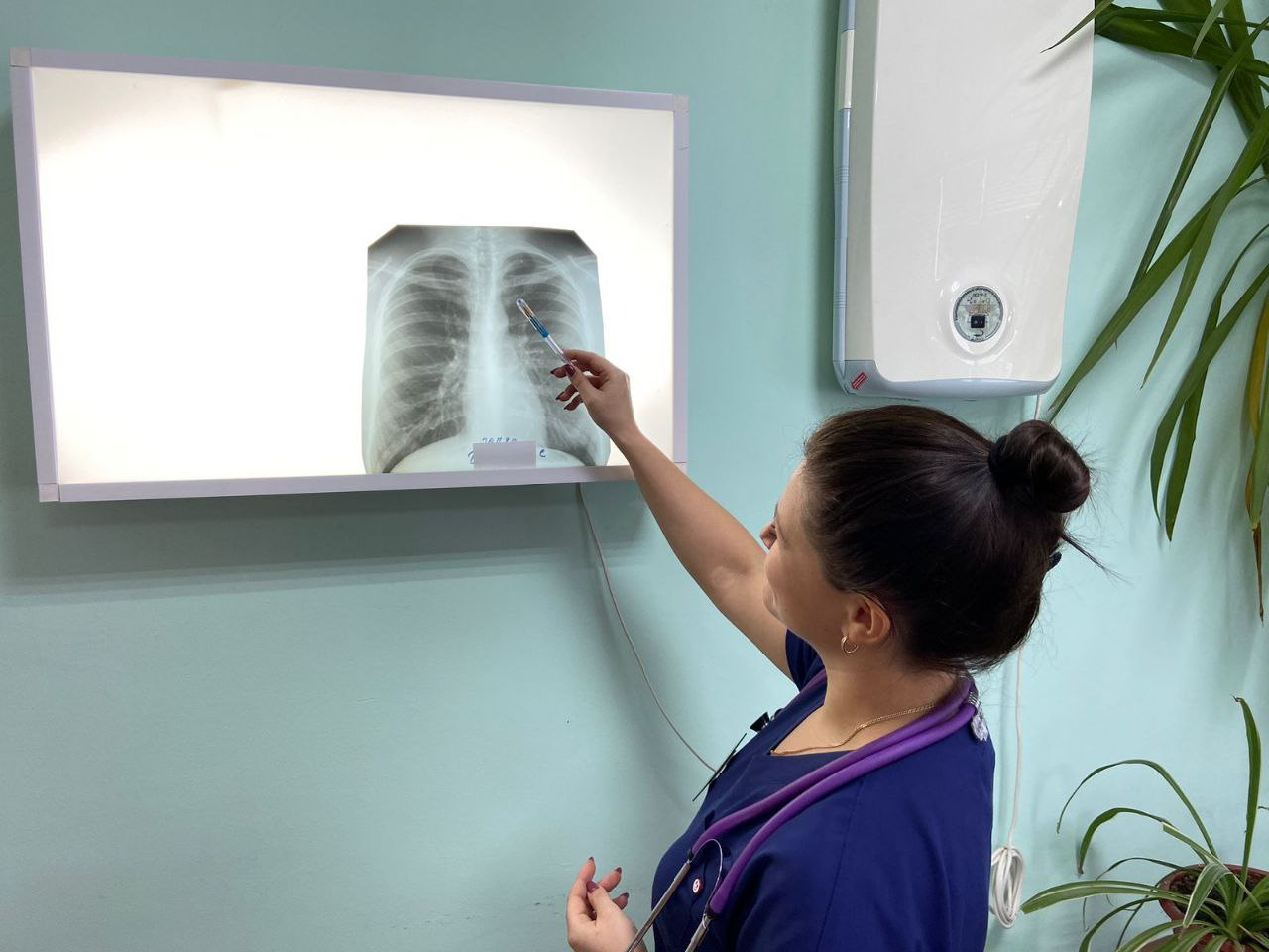 Пензенский врач предупредила об опасности сочетания ВИЧ и туберкулеза