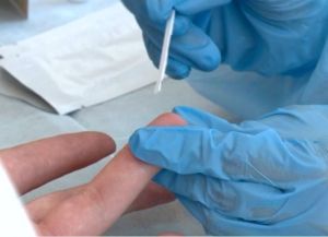 Нарколог Шополов рассказал, как алкоголь влияет на ВИЧ-инфицированных пензенцев