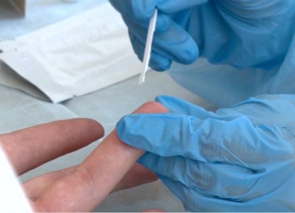 Нарколог Шополов рассказал, как алкоголь влияет на ВИЧ-инфицированных пензенцев