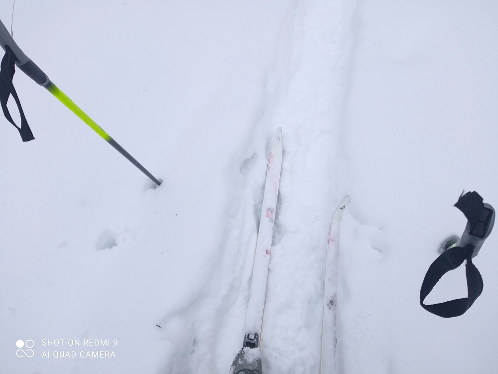 Пензенский Минздрав назвал неожиданные признаки ослабленого иммунитета