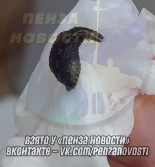 Пензенец нашел паразита на теле после купания в Засечном