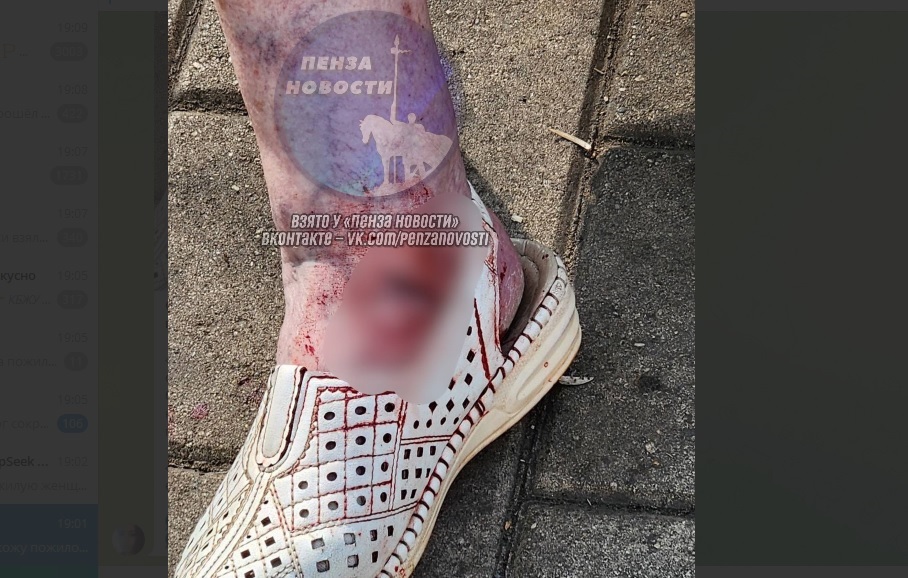 В Пензе собака напала на пожилую женщину в Детском парке