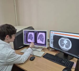 Пензенцы смогут бесплатно пройти флюорографию по субботам в марте